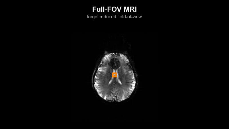 With SelExNet, a tailored pTx RF pulse and spiral gradient waveform are generated from input B0/B1+ maps to produce high-fidelity spatially selective excitation that closely matches the target pattern under patient-specific field conditions and achieve reduced field-of-view imaging at 7T.